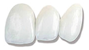 Bild - Veneers